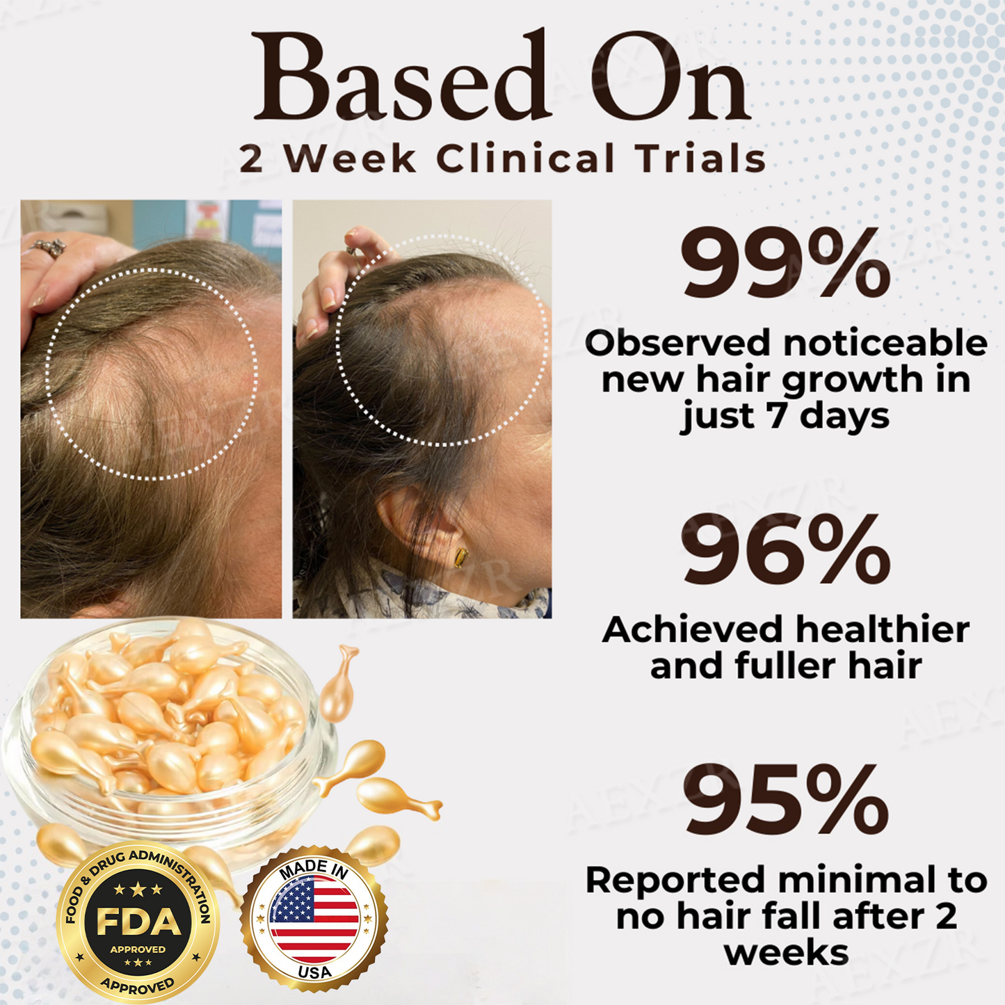 Best Seller 🎉limited-time discount | Acezozla® Hair Regrowth Capsules 💖Revive Follicles, Boost Hair Volume